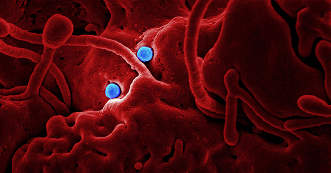 Colorized view of coronavirus.