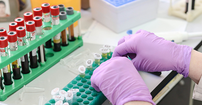 Image of a scientist working in a lab.