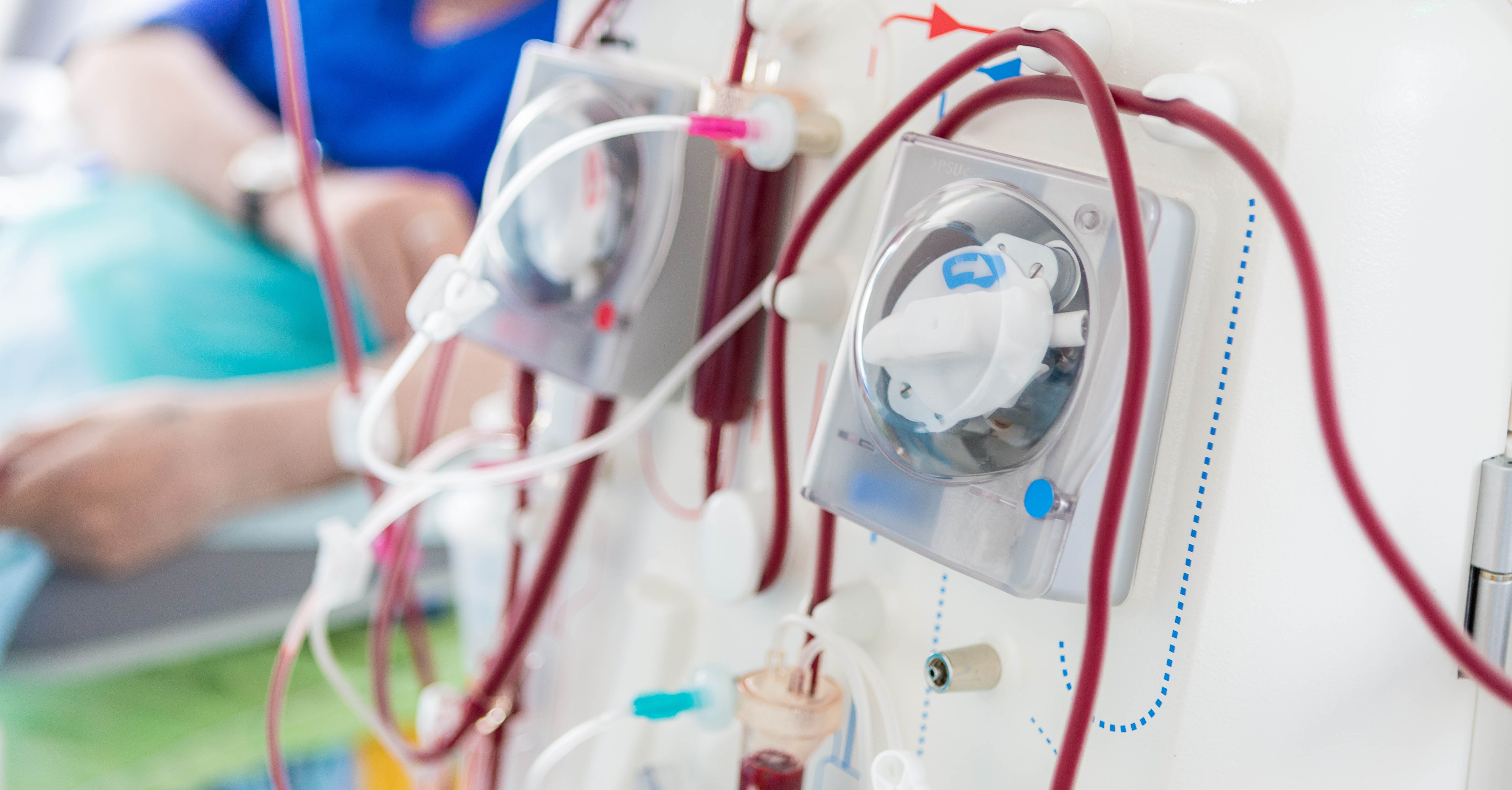 A dialysis machine and a patient in the background.